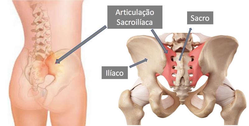 anatomia-da-articulacao-sacroiliaca